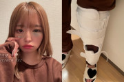 츠바키 리카, 귀가 중 교통사고 당해.. 얼굴과 다리가 많이 부은 상태