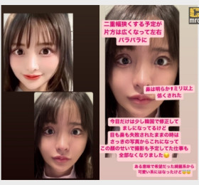 AV 배우 시라하마 노조미, 성형 실패 고백.. 현재 소속사와 계약 해지 상태 + 약혐주의