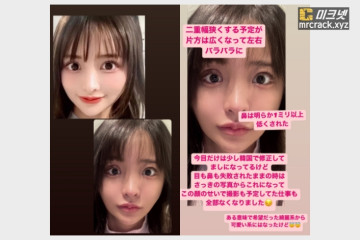 AV 배우 시라하마 노조미, 성형 실패 고백.. 현재 소속사와 계약 해지 상태 + 약혐주의