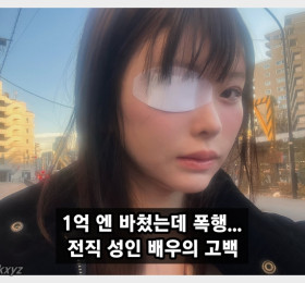 '아스미 미라이' 마츠모토 레이라, 전남친에게 폭행당해.. 피의자는 약 1억엔을 쏟아부었던 호스트