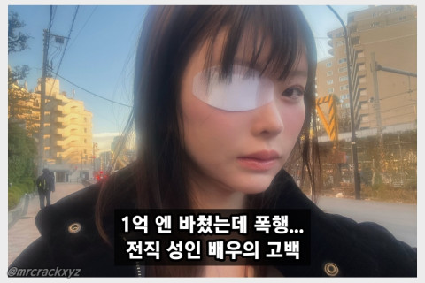 '아스미 미라이' 마츠모토 레이라, 전남친에게 폭행당해.. 피의자는 약 1억엔을 쏟아부었던 호스트