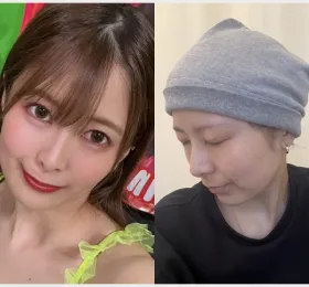 토요오카 사츠키, 항암 치료 중단…내 몸의 한계, 나답게 살아가겠다